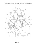 US20220287851A1-patent-drawing