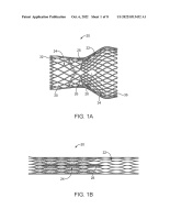 US20220313432A1-patent-drawing