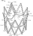 US2022354673A1-patent-drawing