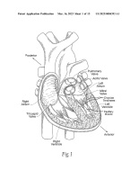 US20230084393A1-patent-drawing