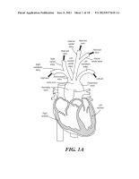 US20230172610A1-patent-drawing