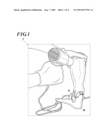 US20230277353A1-patent-drawing