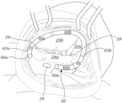 US2025120812A1-patent-drawing