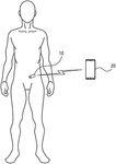 US2025204816A1-patent-drawing
