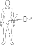 US2025210190A1-patent-drawing