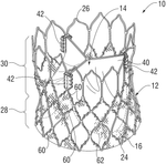 US2025213354A1-patent-drawing