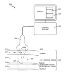 US8690778B2-patent-drawing