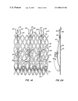 US9005273B2-patent-drawing