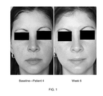 US9763976B1-patent-drawing