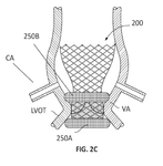 WO2017011199A1-patent-drawing