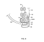 WO2017201196A1-patent-drawing