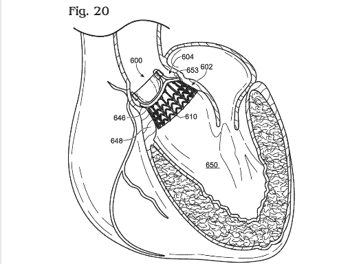 prosthetic-heart-valves-patents